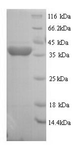 SDS-PAGE