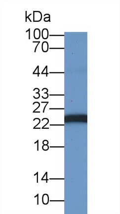 19308