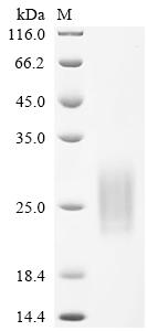 SDS-PAGE