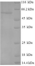 SDS-PAGE