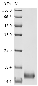 SDS-PAGE