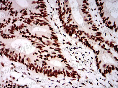 Валидация AntibodySystem RHN83202 (3897)