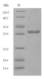 SDS-PAGE