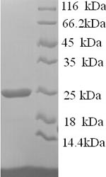 SDS-PAGE
