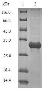 SDS-PAGE