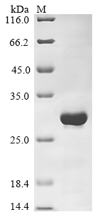SDS-PAGE