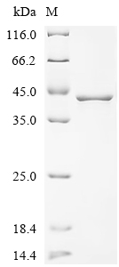 SDS-PAGE