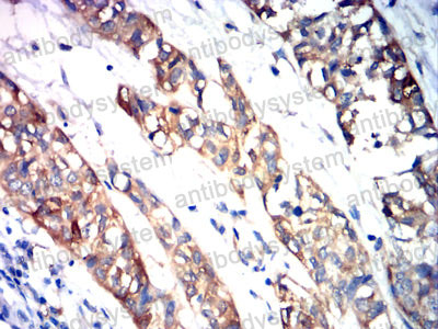 Валидация AntibodySystem RHJ47001 (3431)