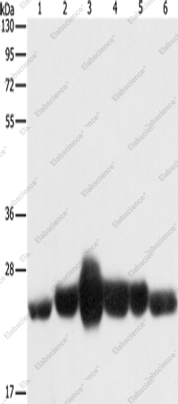 Вестерн-блоттинг, CAV1, ткань плода человека, ткань лейомиосаркомы, ткань мыши, клетки NIH/3T3