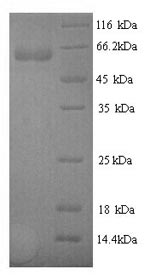 SDS-PAGE