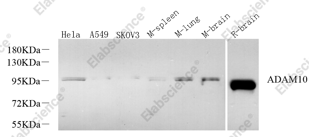 Вестерн-блоттинг, CD156c, различные образцы