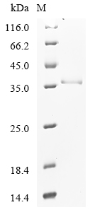 SDS-PAGE