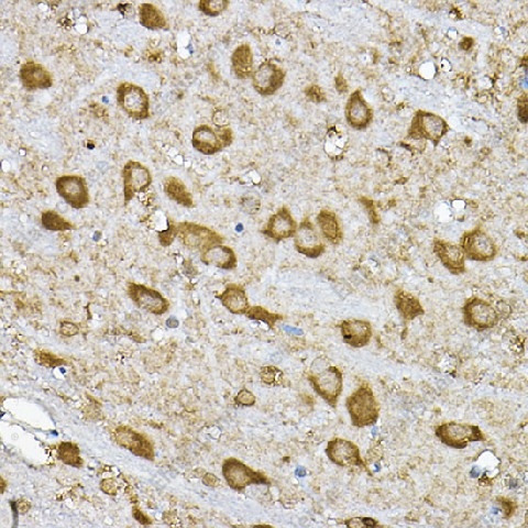 Иммуногистохимия, p70 S6 Kinase 1, ткань мозга крысы