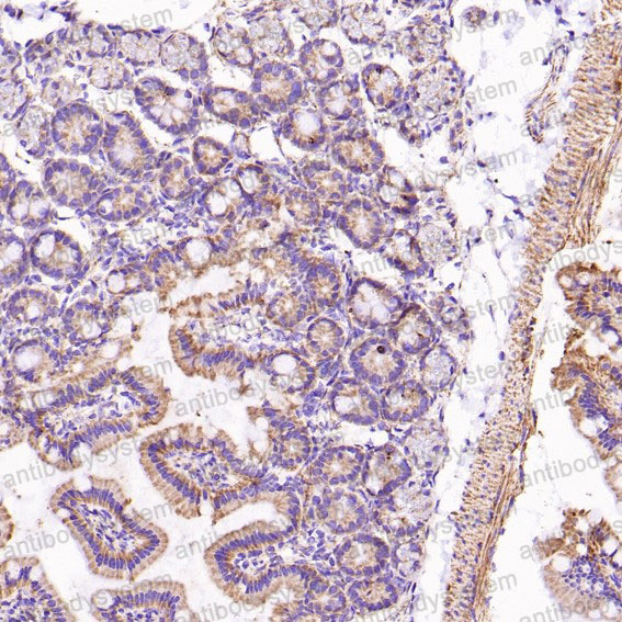 Валидация AntibodySystem RHD47804 (1599)