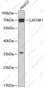 Вестерн-блоттинг, CACNB1, клетки HepG2