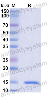 Валидация SDS-PAGE - AntibodySystem RCK81006
