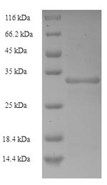 SDS-PAGE