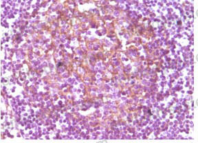 Валидация AntibodySystem RHC33702