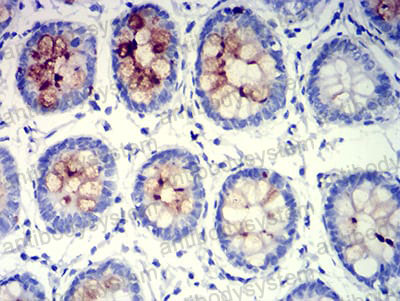 Валидация AntibodySystem RHJ60301