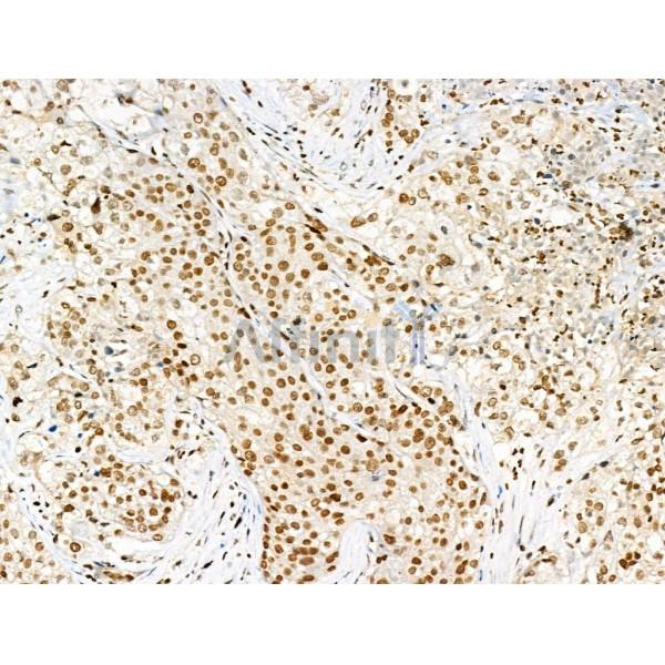 Валидация Affinity AF4364 - 2206