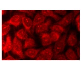 Валидация AssayVector ARM1665(1844)