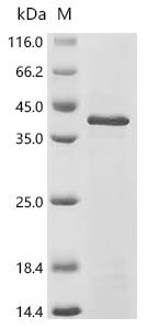 SDS-PAGE