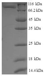 SDS-PAGE