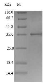 SDS-PAGE