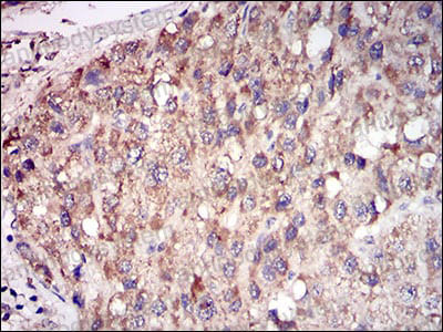 Валидация AntibodySystem RHD00103