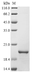 SDS-PAGE