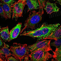 Валидация IF - AntibodySystem RHJ82304