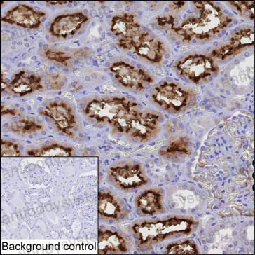 Валидация AntibodySystem RHJ51603