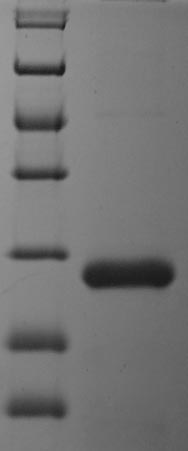 SDS-PAGE