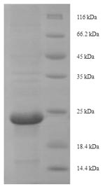 SDS-PAGE