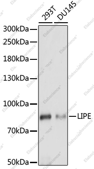 Вестерн-блоттинг, LIPE, различные клеточные линии