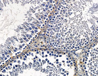 Валидация Affinity DF15766 - 12245