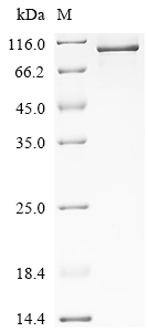 SDS-PAGE