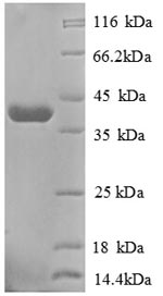 SDS-PAGE