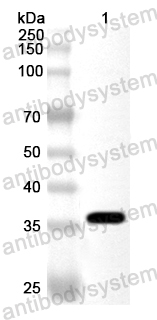 Валидация AntibodySystem PXX20601
