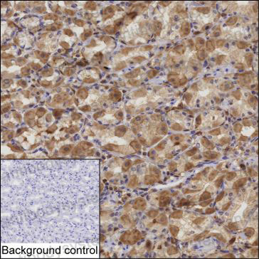 Валидация AntibodySystem RHD91401