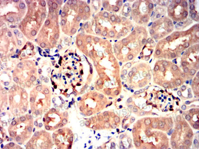 Валидация AntibodySystem RHB26402