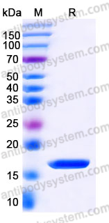 YHJ69102, SDS-PAGE