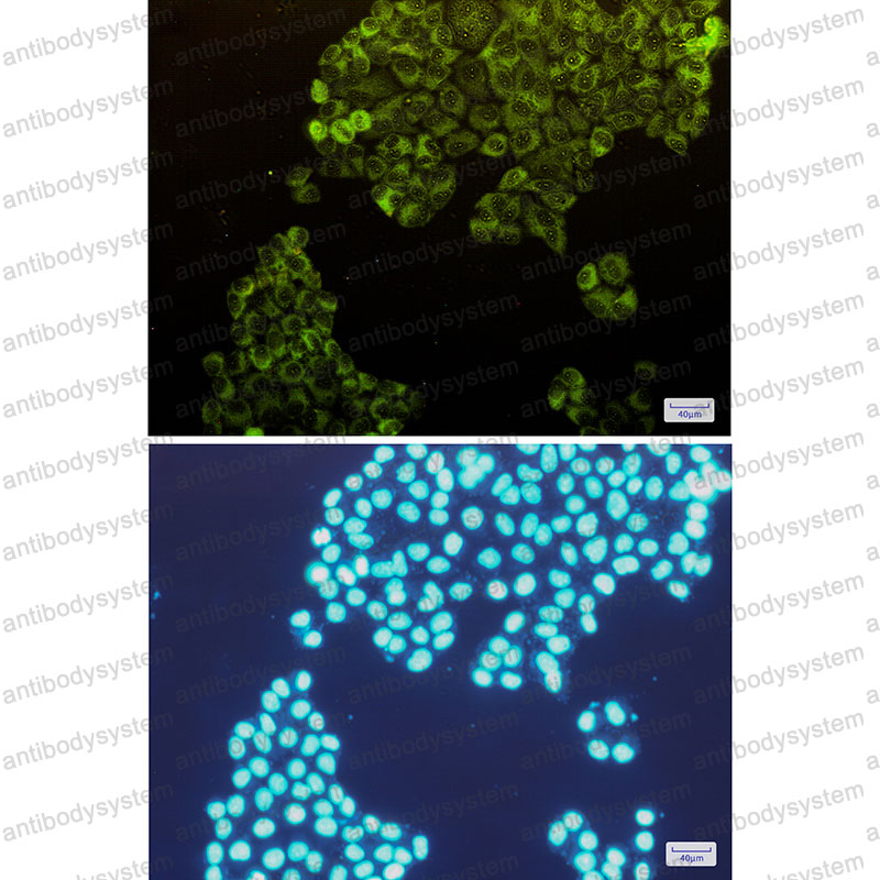 Валидация IF - AntibodySystem RHC31701