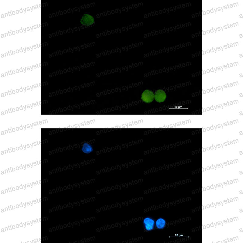 Валидация IF - AntibodySystem RHE47701