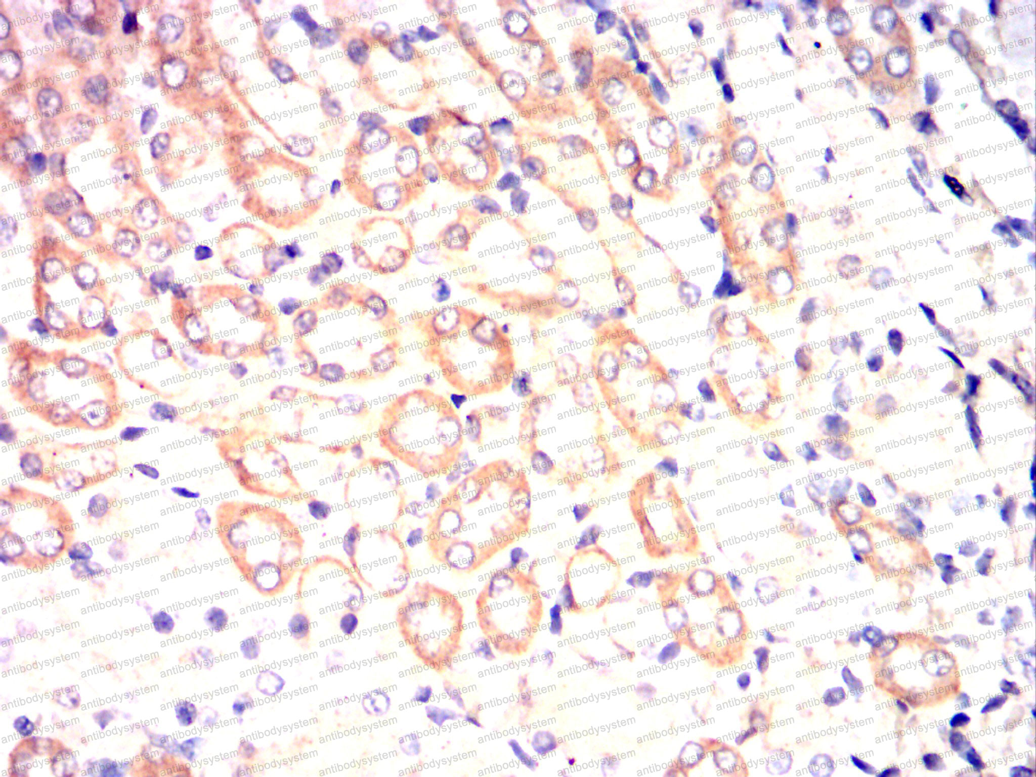Валидация AntibodySystem RHC87201