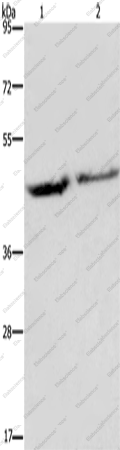 Вестерн-блоттинг, EIF3H, ткань феохромоцитомы надпочечника человека и ткань мозга плода