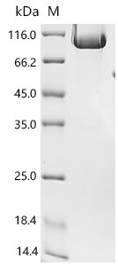 SDS-PAGE