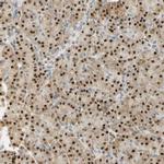 Валидация AssayVector ARM2098(3313)