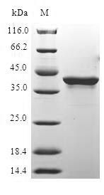 SDS-PAGE