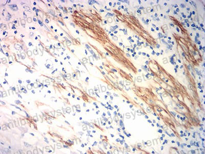 Валидация AntibodySystem RHF52704